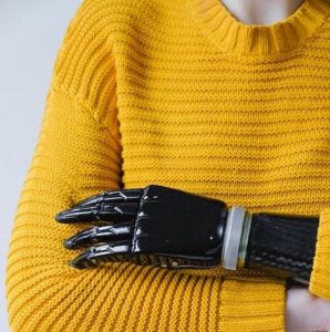 startup with disability: prosthetic hand